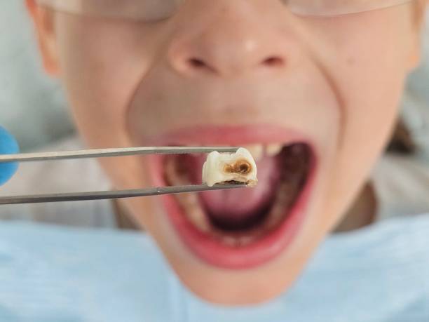 Best Tooth Pain Emergency Relief  in Johnson Creek, WI